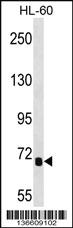 Anti-IL1RAPL2 Rabbit Polyclonal Antibody