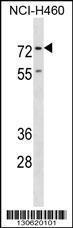 Anti-ENAH Rabbit Polyclonal Antibody (AP (Alkaline Phosphatase))