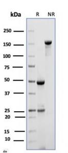 SDS-PAGE analysis of Anti-CD10 Antibody [MME/6714] under non-reduced and reduced conditions; showing intact IgG and intact heavy and light chains, respectively. SDS-PAGE analysis confirms the integrity and purity of the antibody.