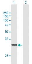 Anti-ZFAND3 Mouse Polyclonal Antibody