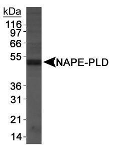 Anti-SERPINB5 Rabbit Polyclonal Antibody