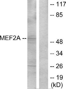 Western blot analysis of lysates from NIH/3T3 cells, treated with PMA using Anti-MEF2A Antibody. The right hand lane represents a negative control, where the antibody is blocked by the immunising peptide.