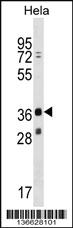 Anti-MAGEB16 Rabbit Polyclonal Antibody