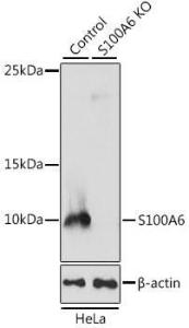 Western blot analysis of extracts from normal (control) and S100A6 knockout (KO) HeLa cells, using Anti-S100 alpha 6 / PRA Antibody (A11719) at 1:1000 dilution