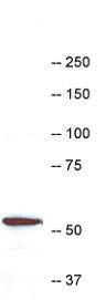 Western blot of HL60 cell extract stained with Anti-Coronin 1a Antibody (1:10000). A prominent band running with an apparent SDS-PAGE molecular weight of ~57 kDa corresponds to Coronin 1a. Numbers represent positions of molecular weight standards in kDa