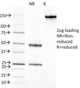 SDS-PAGE analysis of Anti-Retinol Binding Protein Antibody [G4E4] under non-reduced and reduced conditions; showing intact IgG and intact heavy and light chains, respectively SDS-PAGE analysis confirms the integrity and purity of the antibody