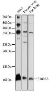 Western blot analysis of extracts of various cell lines, using Anti-S100 alpha 6 / PRA Antibody (A11719) at 1:1000 dilution