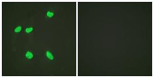 Antibody anti-histone H4 acetyl LYS16