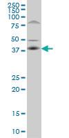 Anti-FRA10AC1 Mouse Monoclonal Antibody [clone: 2C4]