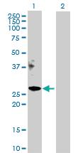 Anti-APOM Rabbit Polyclonal Antibody