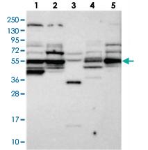 Anti-POC5 Rabbit Polyclonal Antibody