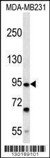 Anti-FSD2 Rabbit Polyclonal Antibody (FITC (Fluorescein Isothiocyanate))