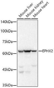 Western blot analysis of extracts of various cell lines, using Anti-EPHX2 Antibody [ARC2895] (A307925) at 1:500 dilution