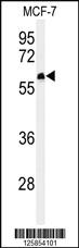 Anti-FA20A Rabbit Polyclonal Antibody