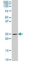 Anti-PCMT1 Mouse Monoclonal Antibody [clone: 4G9]