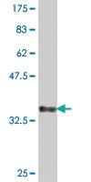 Anti-NADSYN1 Mouse Polyclonal Antibody