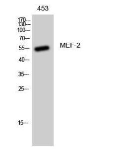 Western blot analysis of 453 cells using Anti-MEF2A Antibody