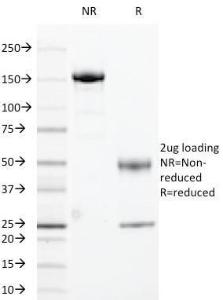 SDS-PAGE analysis of Anti-Cyclin B1 Antibody [CCNB1/1098] under non-reduced and reduced conditions; showing intact IgG and intact heavy and light chains, respectively. SDS-PAGE analysis confirms the integrity and purity of the antibody.