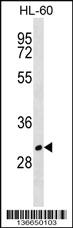 Anti-MS4A1 Rabbit Polyclonal Antibody