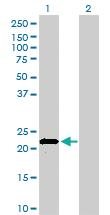 Anti-APOM Mouse Monoclonal Antibody [clone: 1F10]