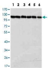 Anti-PARP1 Mouse Monoclonal Antibody [clone: 7A10]