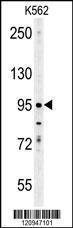 Anti-ENAM Rabbit Polyclonal Antibody (Biotin)