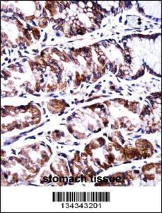 Anti-PPEF2 Rabbit Polyclonal Antibody