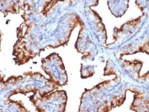 Immunohistochemical analysis of formalin-fixed, paraffin-embedded human prostate tissue using Anti-CD10 Antibody [MME/6714]