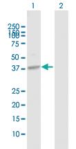 Anti-SRR Rabbit Polyclonal Antibody