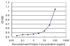 Anti-COMT Polyclonal Antibody Pair