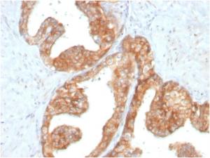 Anti-RET antibody