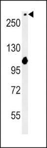 Anti-NOTCH3 Rabbit Polyclonal Antibody (AP (Alkaline Phosphatase))