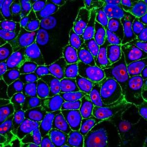 Immunofluorescent staining of MCF-7 cells stained with Anti-Cyclin B1 Antibody [CCNB1/1098] (CF&#174; 555) (Red). Actin filaments are stained with Phalloidin-CF&#174; 488A (Green). DNA is stained with Hoechst (Blue).