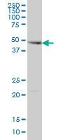 Anti-RNF168 Mouse Monoclonal Antibody [clone: 3E1]