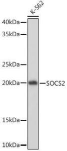 Western blot analysis of extracts of K-562 cells, using Anti-SOCS2 Antibody [ARC1470] (A307926) at 1:1,000 dilution