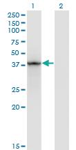 Anti-STAT5B Mouse Monoclonal Antibody [clone: 1A1]