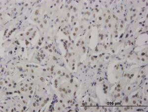 Anti-RNF168 Mouse Monoclonal Antibody [clone: 3E1]