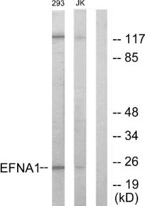 Western blot analysis of lysates from 293 and Jurkat cells using Anti-EFNA1 Antibody. The right hand lane represents a negative control, where the antibody is blocked by the immunising peptide.