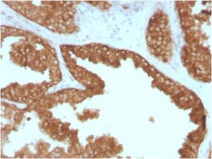 Anti-RET antibody