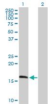 Anti-MRPS11 Mouse Polyclonal Antibody