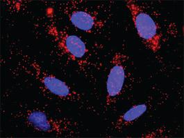 Anti-NFKB1 Antibody Pair