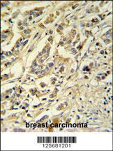 Anti-SMPDL3A Rabbit Polyclonal Antibody (AP (Alkaline Phosphatase))