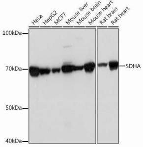 Western blot analysis of extracts of various cell lines, using Anti-SDHA Antibody [ARC0726] (A306485) at 1:1,000 dilution. The secondary antibody was Goat Anti-Rabbit IgG H&L Antibody (HRP) at 1:10,000 dilution.