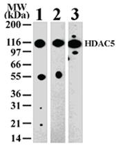 Anti-HDAC5 Rabbit Polyclonal Antibody