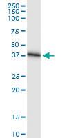 Anti-SRR Rabbit Polyclonal Antibody