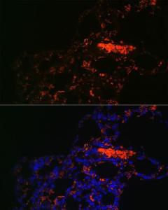 Immunofluorescence analysis of rat lung using Anti-ABCG1 Antibody (A11743) at a dilution of 1:100. DAPI was used to stain the cell nuclei (blue)