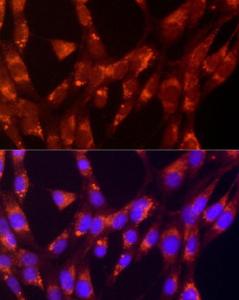 Immunofluorescence analysis of NIH/3T3 cells using Anti-LAMP1 Antibody (A309397) at a dilution of 1:50 (40x lens) DAPI was used to stain the cell nuclei (blue)