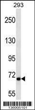 Anti-CPEB3 Rabbit Polyclonal Antibody (PE (Phycoerythrin))