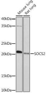 Western blot analysis of extracts of various cell lines, using Anti-SOCS2 Antibody [ARC1470] (A307926) at 1:1,000 dilution