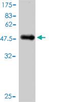 Anti-NUDT3 Mouse Monoclonal Antibody [clone: 3C5]